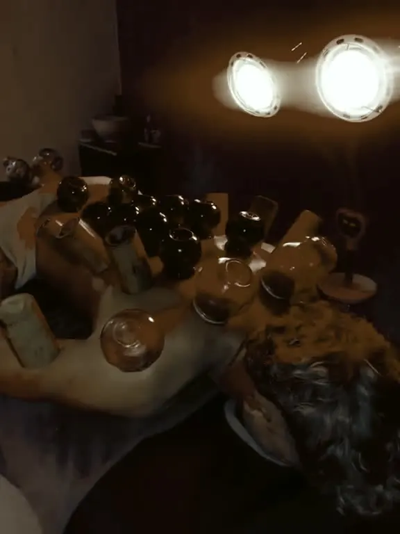 Cuppingbehandeling op de rug in de praktijkruimte
